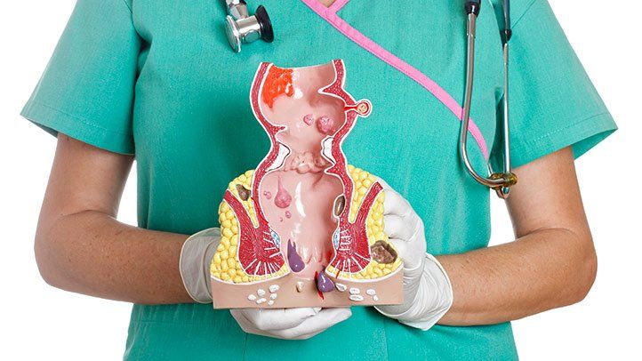 Fissure Treatment | Dr. Neeraj Chaudhary