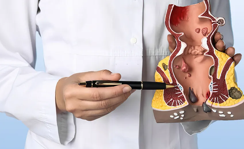 Piles Treatment in Delhi | Dr. Neeraj Chaudhary