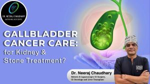 Best GI Cancer Surgeon Gallbladder Cancer Care Guide