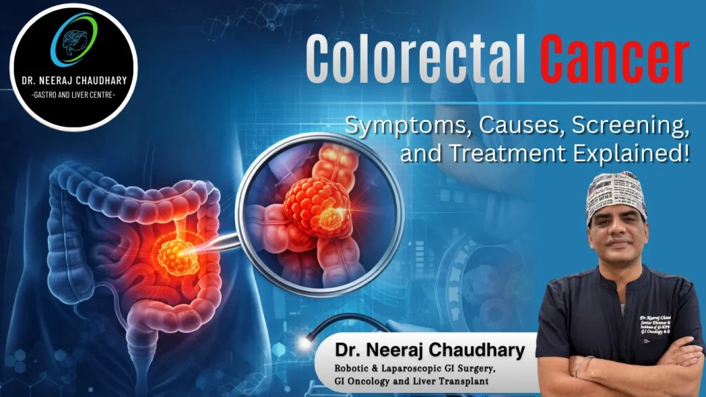 Colorectal Cancer Symptoms, Causes, Screening, and Treatment Explained