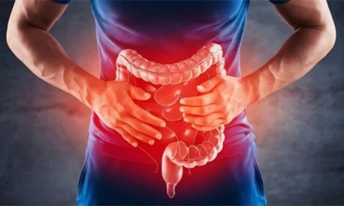 GI Surgery